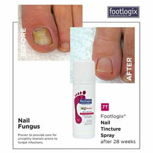 Load image into Gallery viewer, footlogix NAIL TINCTURE SPRAY BEFORE AND AFTER 28 WEEKS
