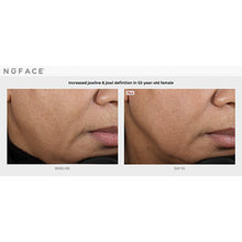 Load image into Gallery viewer, NuFACE before and after  jawline
