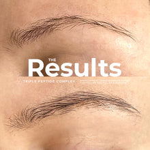 Load image into Gallery viewer, Adoreyes brow serum before and after photo
